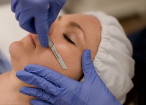 Dermaplaning