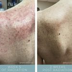 Before + After - Radiation Skin Care