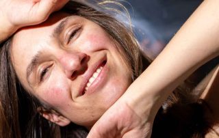 How NeoGenesis MB-1 Balances My Rosacea Regimen