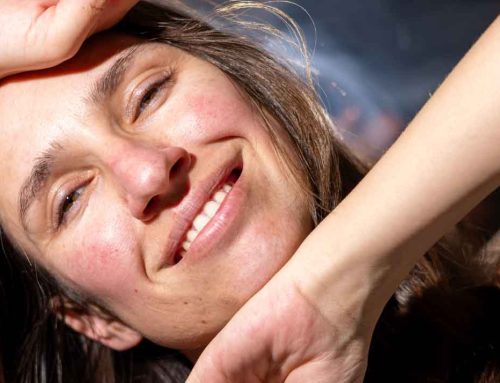 How NeoGenesis MB-1 Balances My Rosacea Regimen